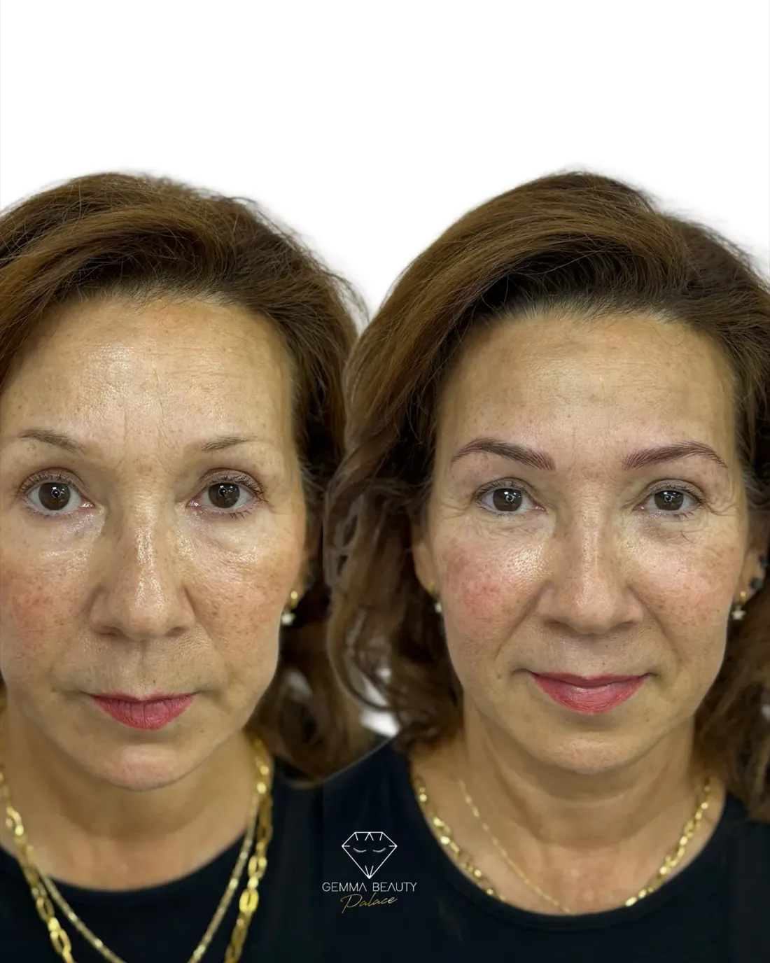 Cejas definidas mediante micropigmentación personalizada