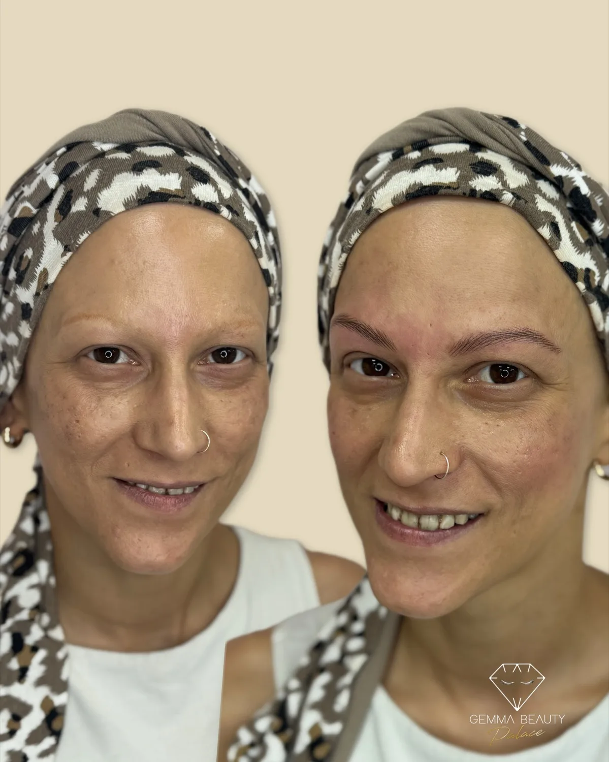 Resultado natural de restauración de cejas pelo a pelo